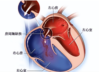 64d597df7a7c4.png image.png